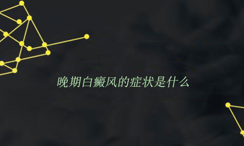 晚期白癜風(fēng)的癥狀是什么